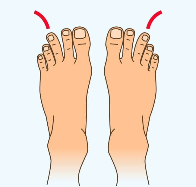 Узнать характер по ногам - Наклоненный третий палец
