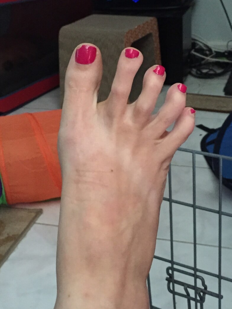 Узнать характер по ногам - Узкий второй палец